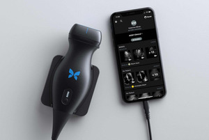 Butterfly iQ (Handheld Ultrasound) | 3 Month Pro ...