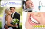 $69 for mobile teeth whitening (they come to you!) - normally $139! Save $70