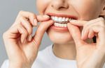 Daytime Dual Arch Clear Aligners $1060 (Was $1360) Delivered @ Smileie Australia